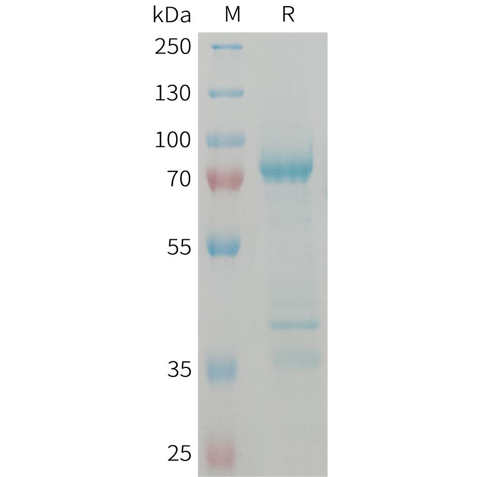 Human GDF8 Protein, hFc Tag