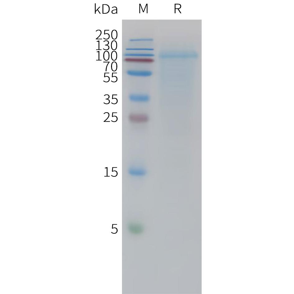 Human LINGO1 Protein, His Tag