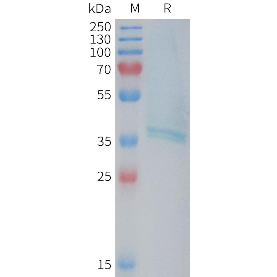 Human RAMP1 Protein, mFc Tag