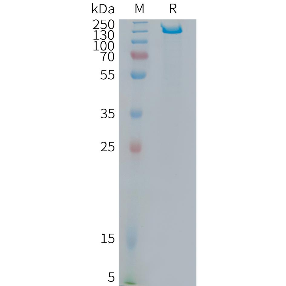 Human ITGB6 Protein, hFc Tag