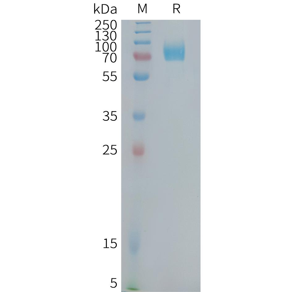 Human CD22(417-678) Protein, hFc Tag