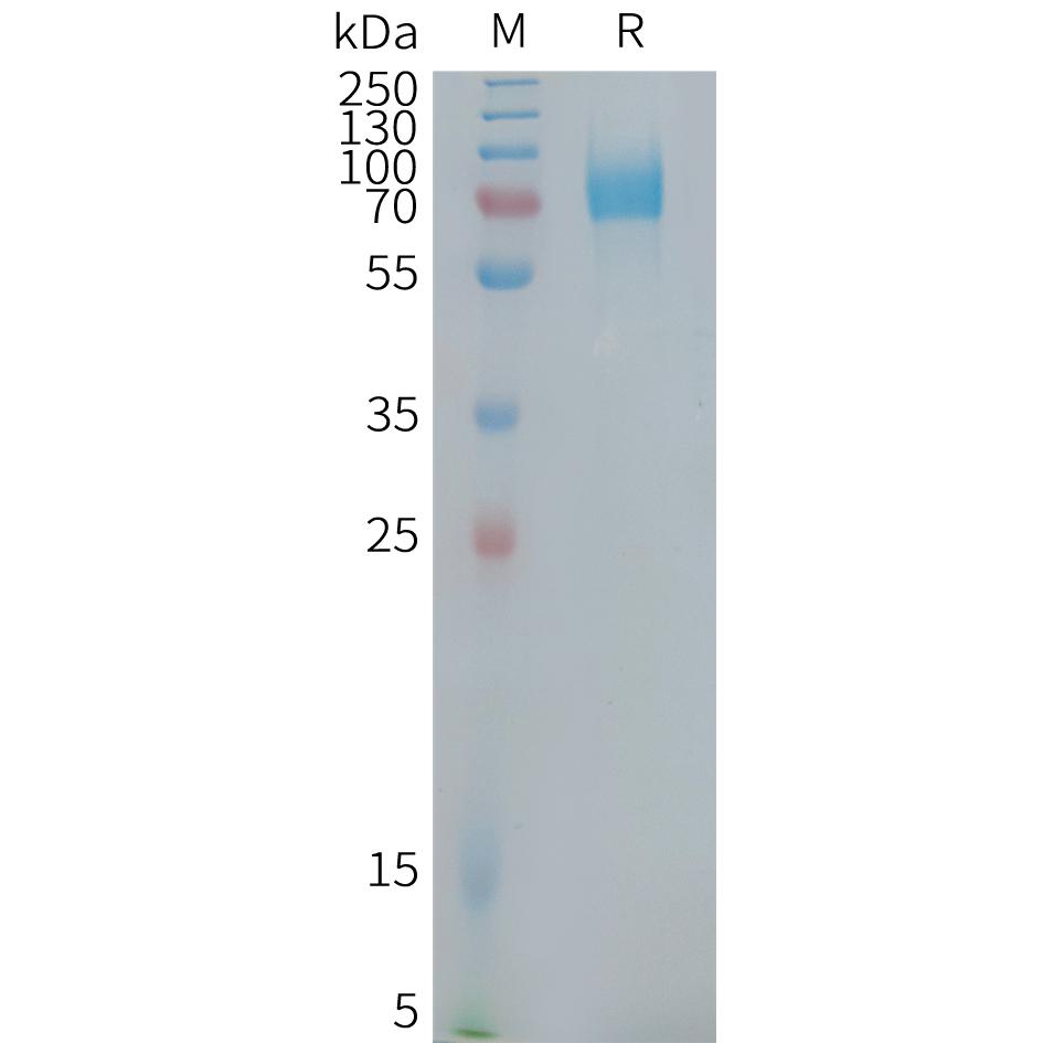 Human CD22(417-678) Protein, mFc Tag