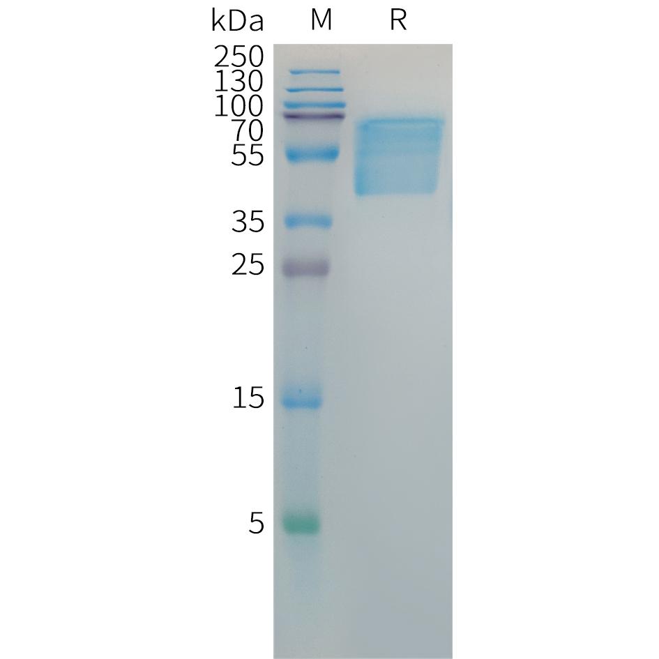 Hepatitis B virus HBSAG Protein, hFc Tag