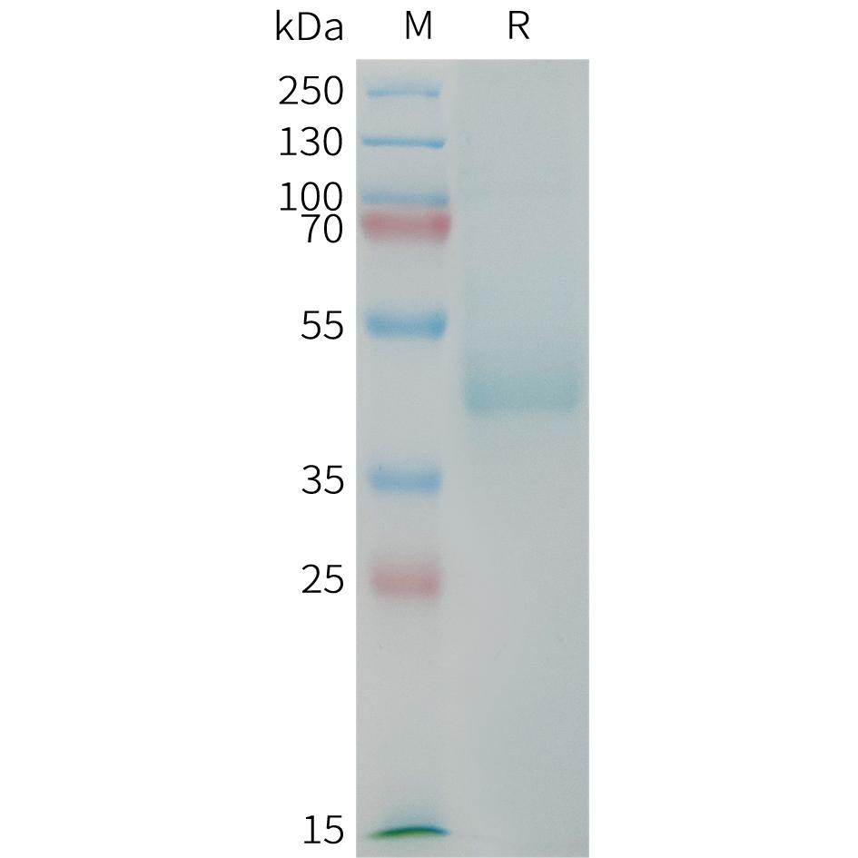 Human CDH17(567-667) Protein, mFc Tag