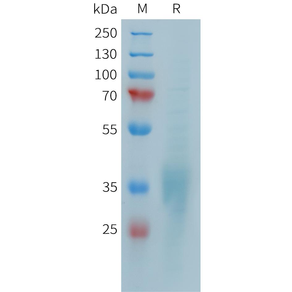 Human CD28 Protein, His Tag