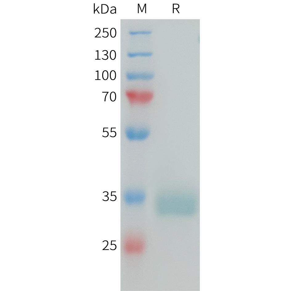 Human PRLR Protein, His Tag