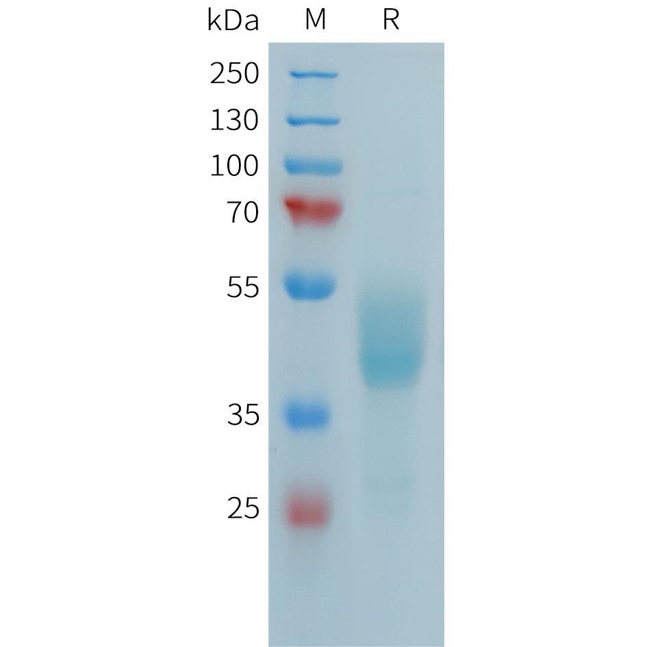 Human FCRL5(752-834) Protein, hFc Tag