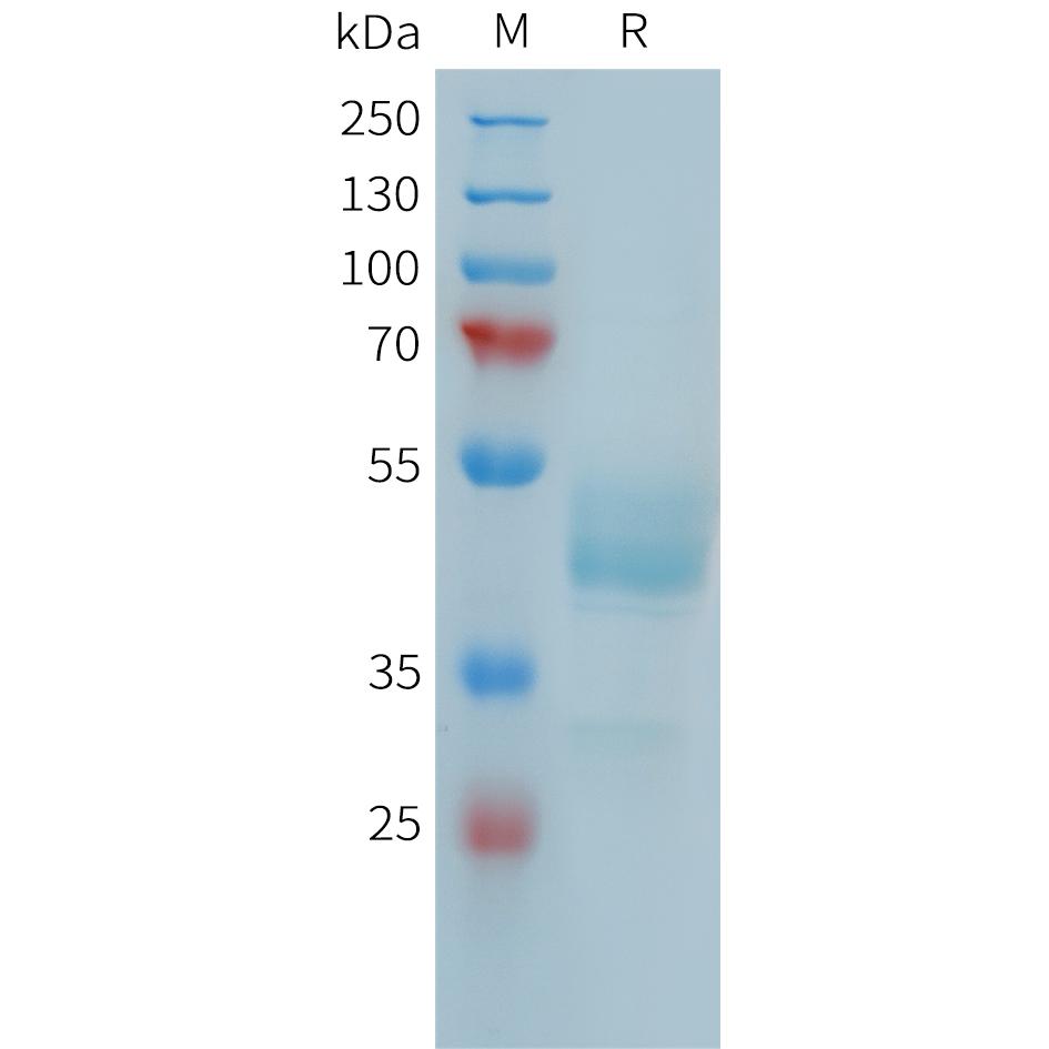 Human FCRL5(752-834) Protein, mFc Tag