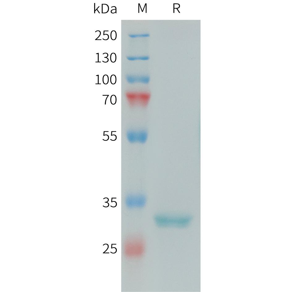 Human FCN1 Protein, His Tag