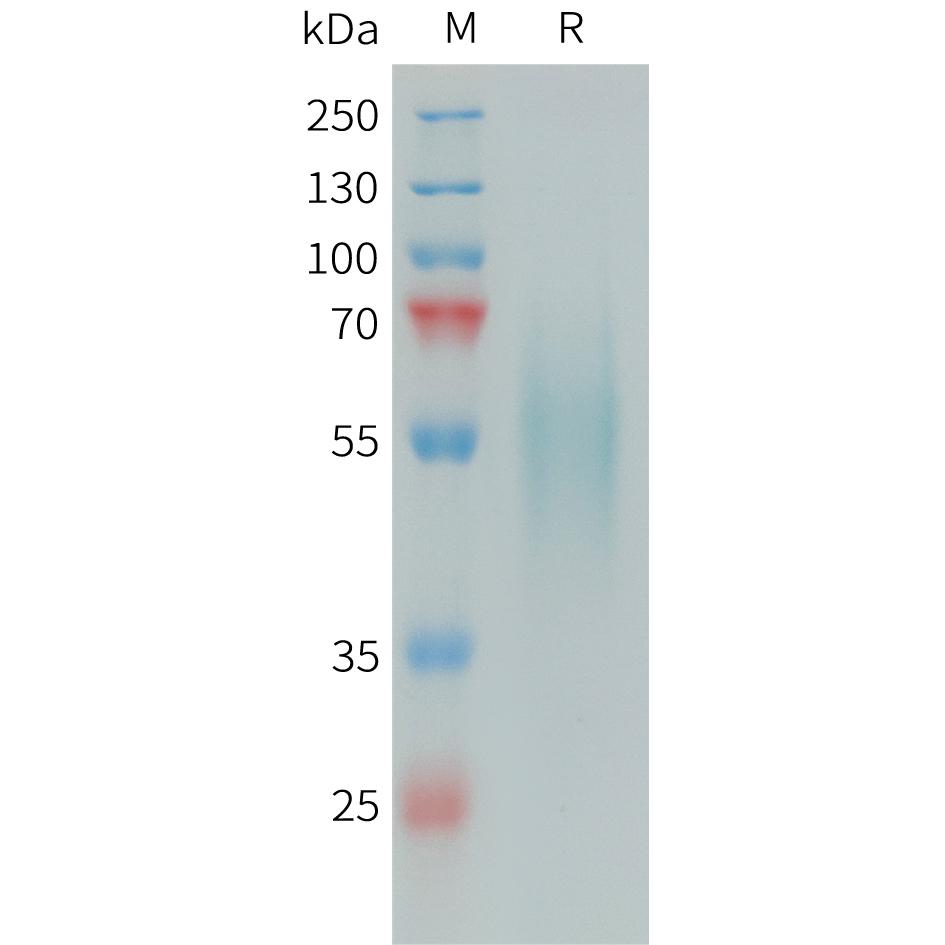 Human DR6 Protein, His Tag