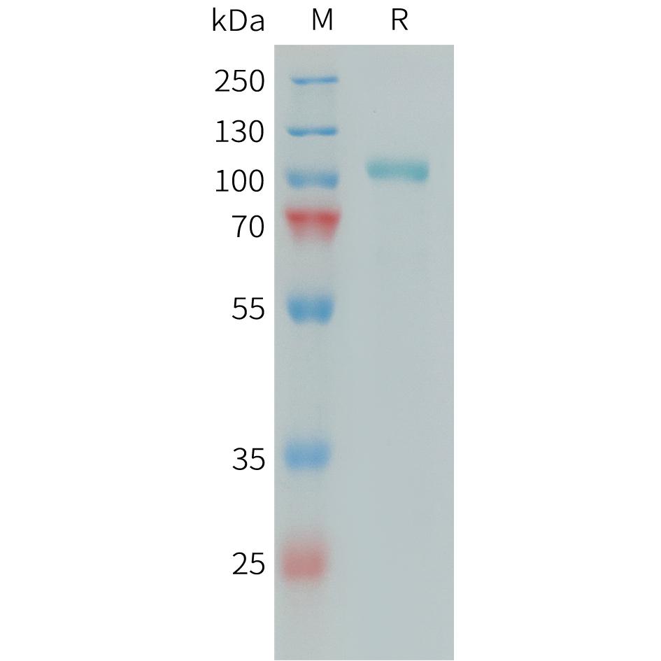 Human C1S Protein, His Tag