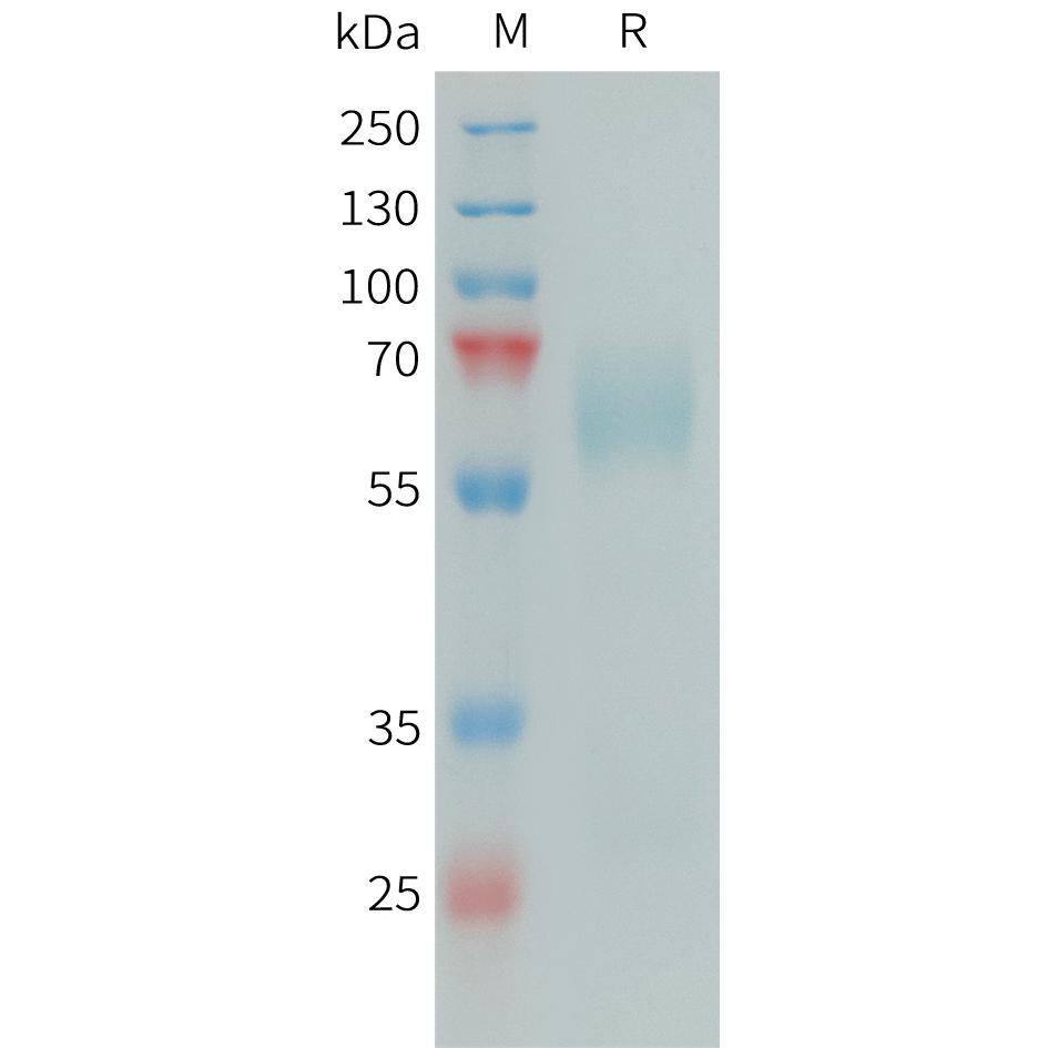 Human SAP Protein, His Tag