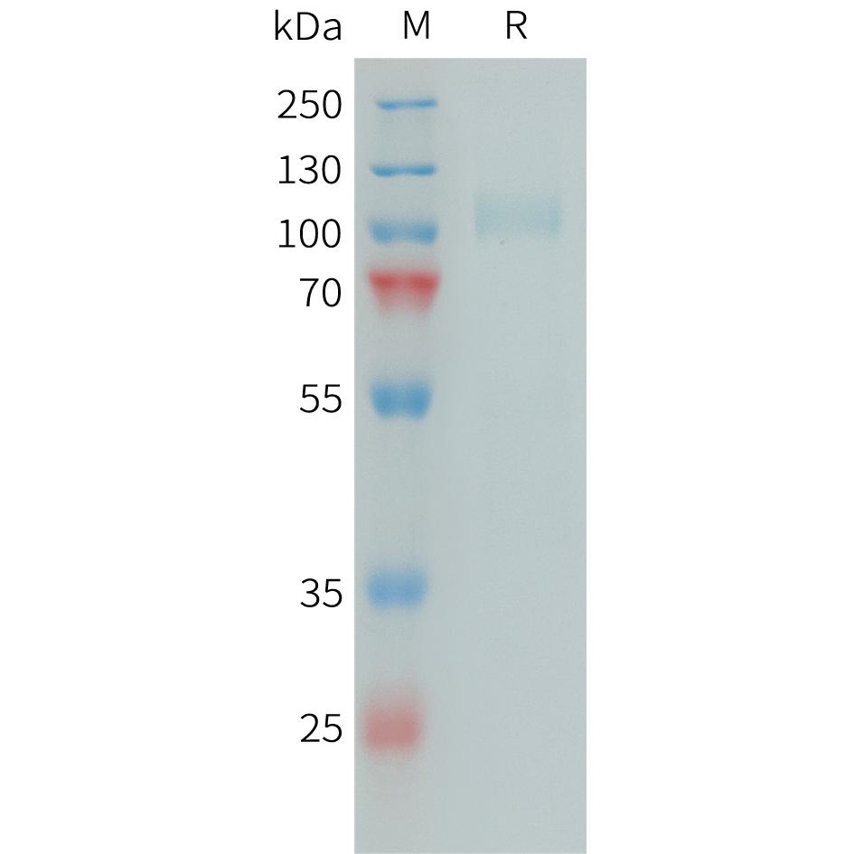 Human CFI Protein, His Tag