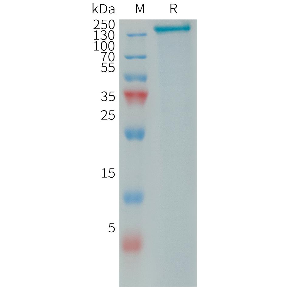 Human PLA2R1 Protein, His Tag