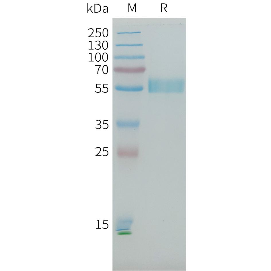 Human PLA2R1(21-164+223-359+1097-1246) Protein, His Tag