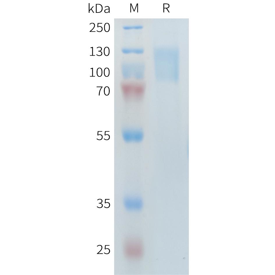 Human PLA2R1(21-521+1097-1246) Protein, His Tag