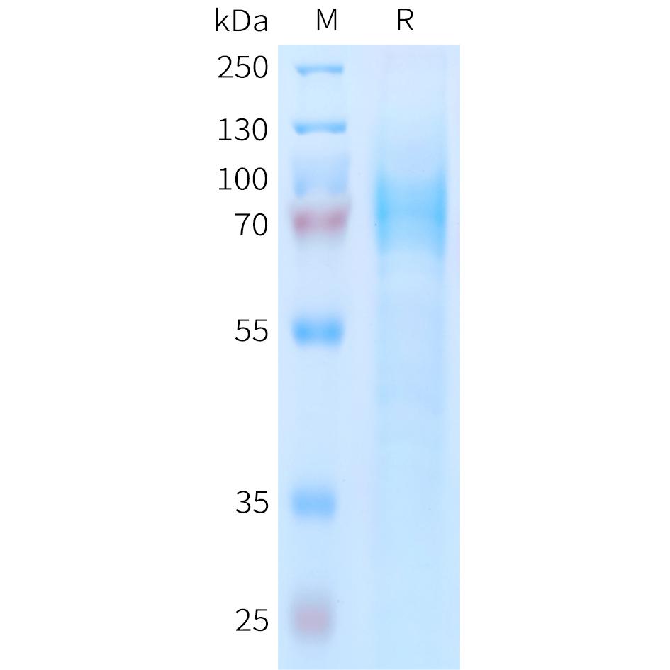 Human ADGRE5 Protein, His Tag