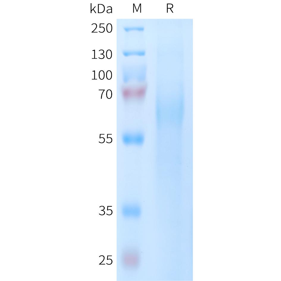 Human TIM4 Protein, His Tag