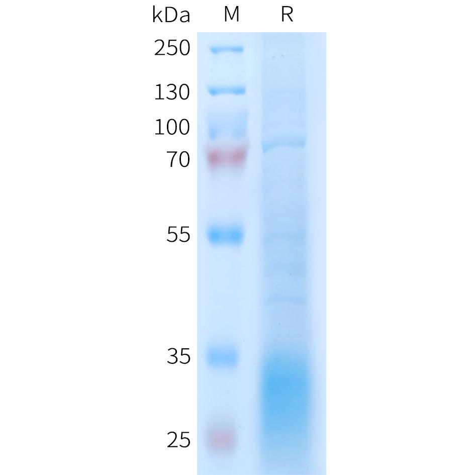 Human GLP2R Protein, His Tag