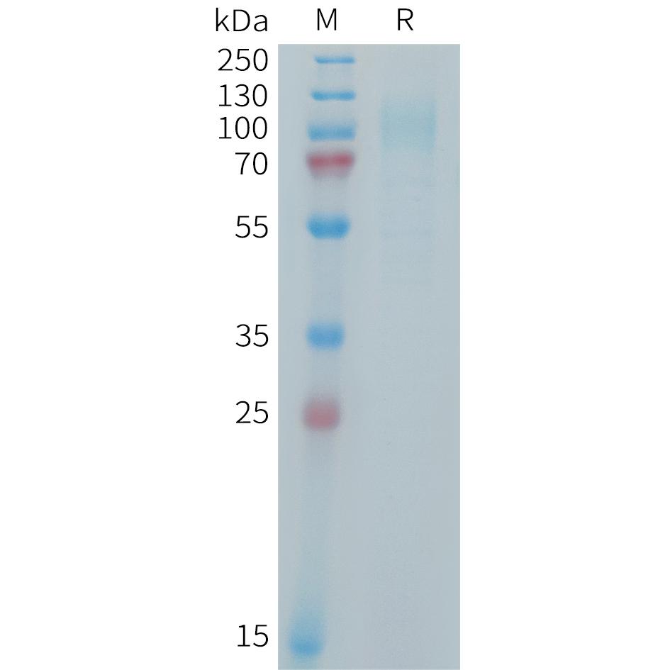 Human IL31RA Protein, His Tag