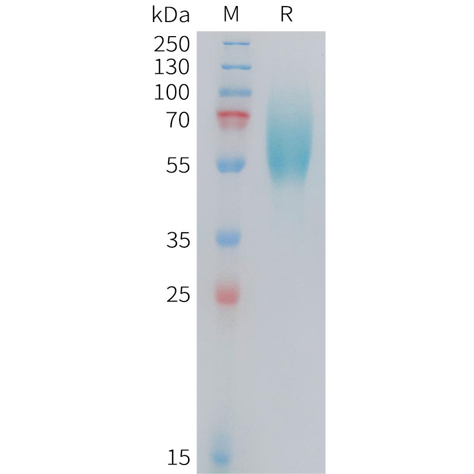 Human FGFR2IIIb Protein, His Tag