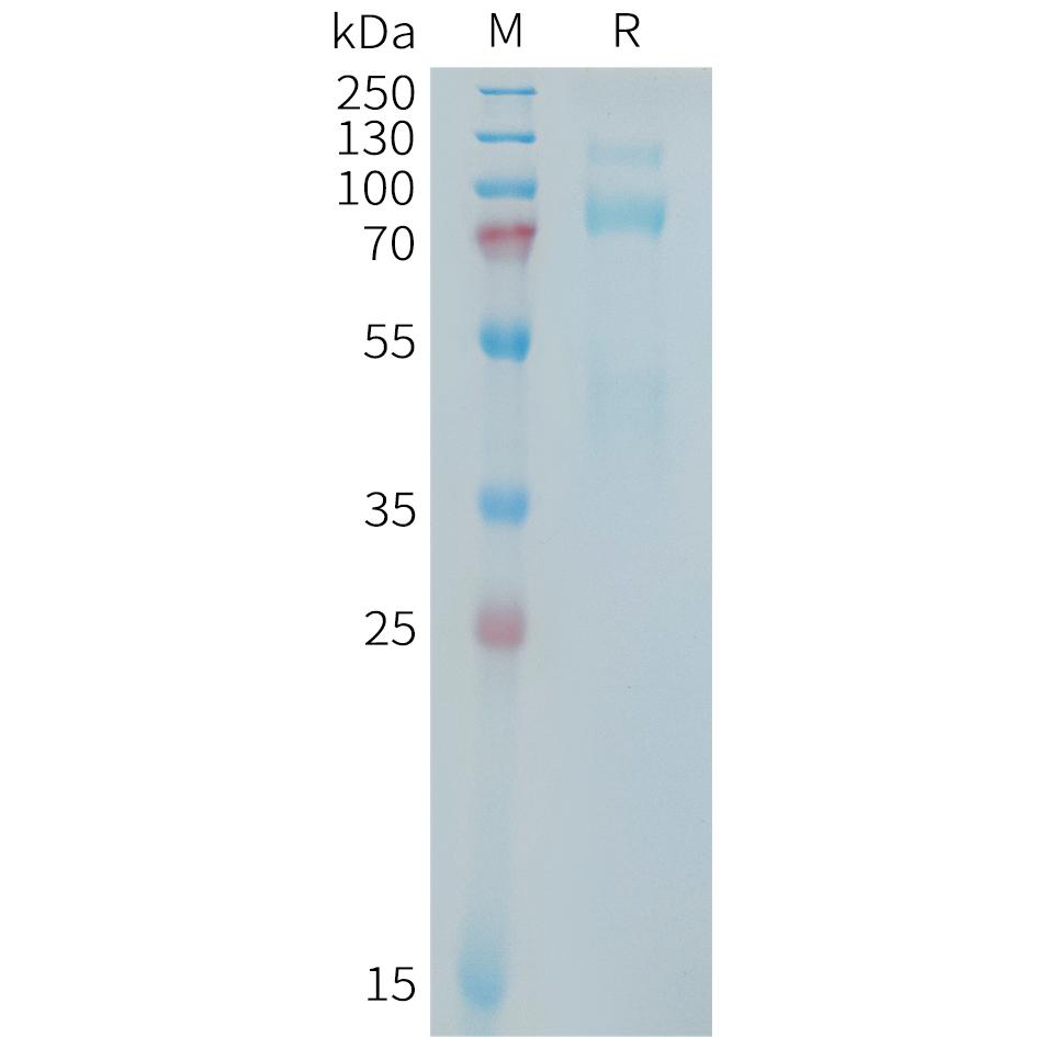 Human MET Protein, hFc Tag