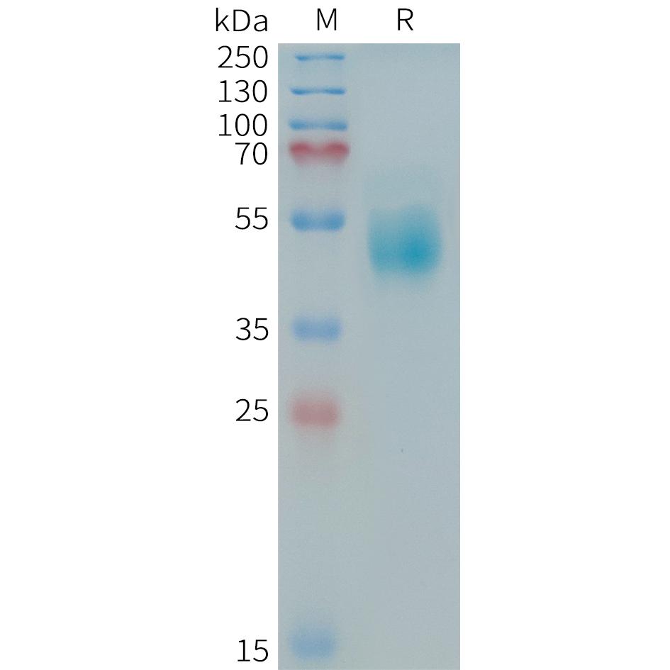 Human HER3(544-643) Protein, hFc Tag