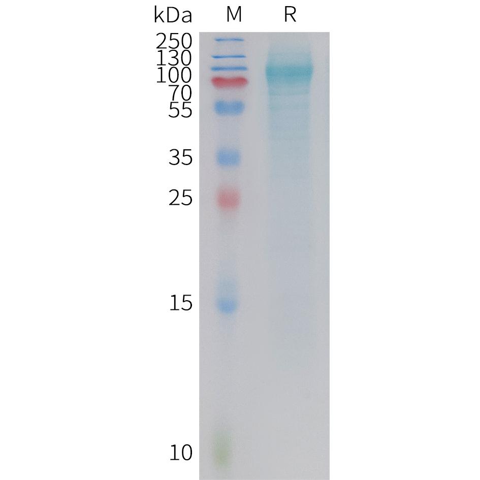 Human ADGRD1 Protein, His Tag