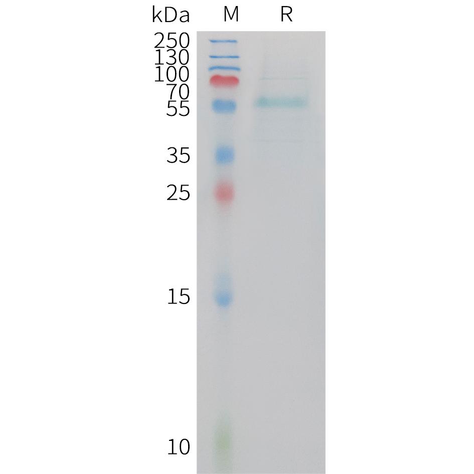 Human ADIPOQ Protein, hFc Tag