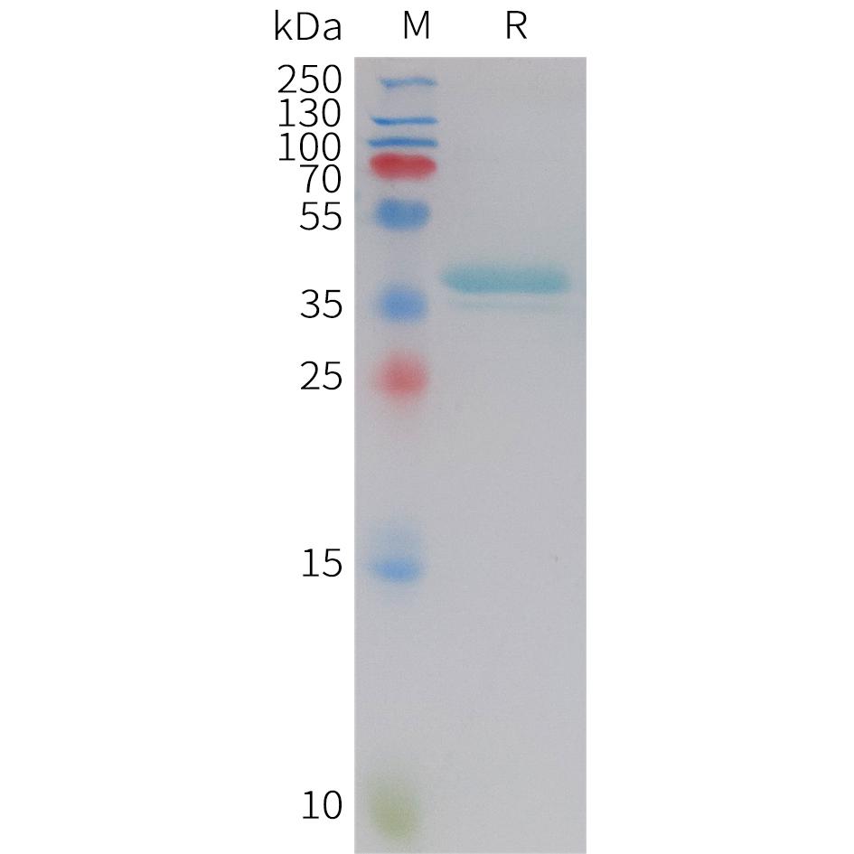 Human LEP Protein, hFc Tag