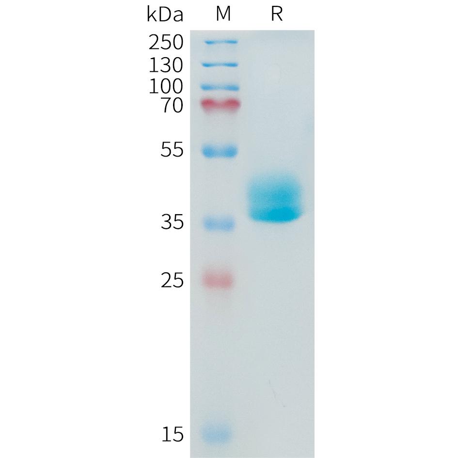 Human ADAM17(581-642) Protein, mFc Tag