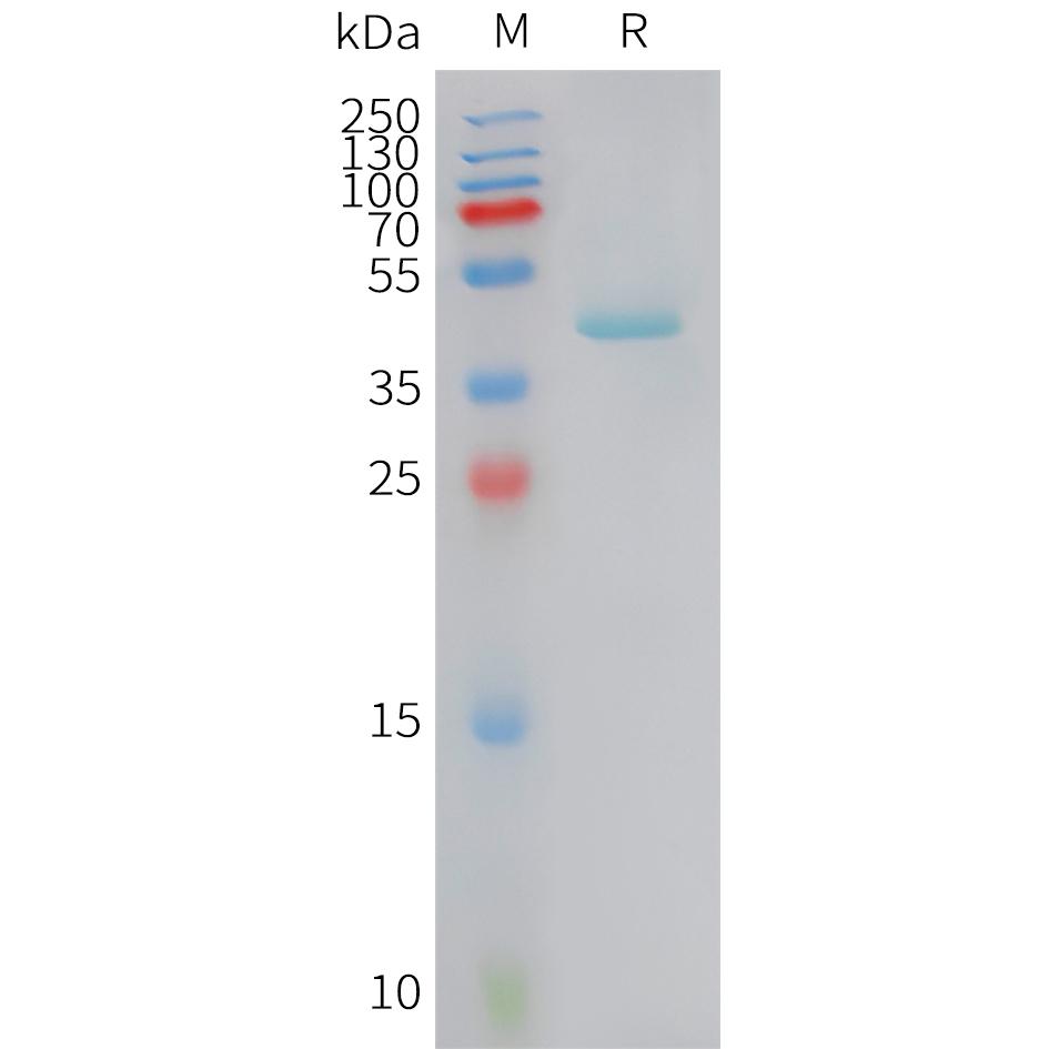 Human CCL5 Protein, hFc Tag