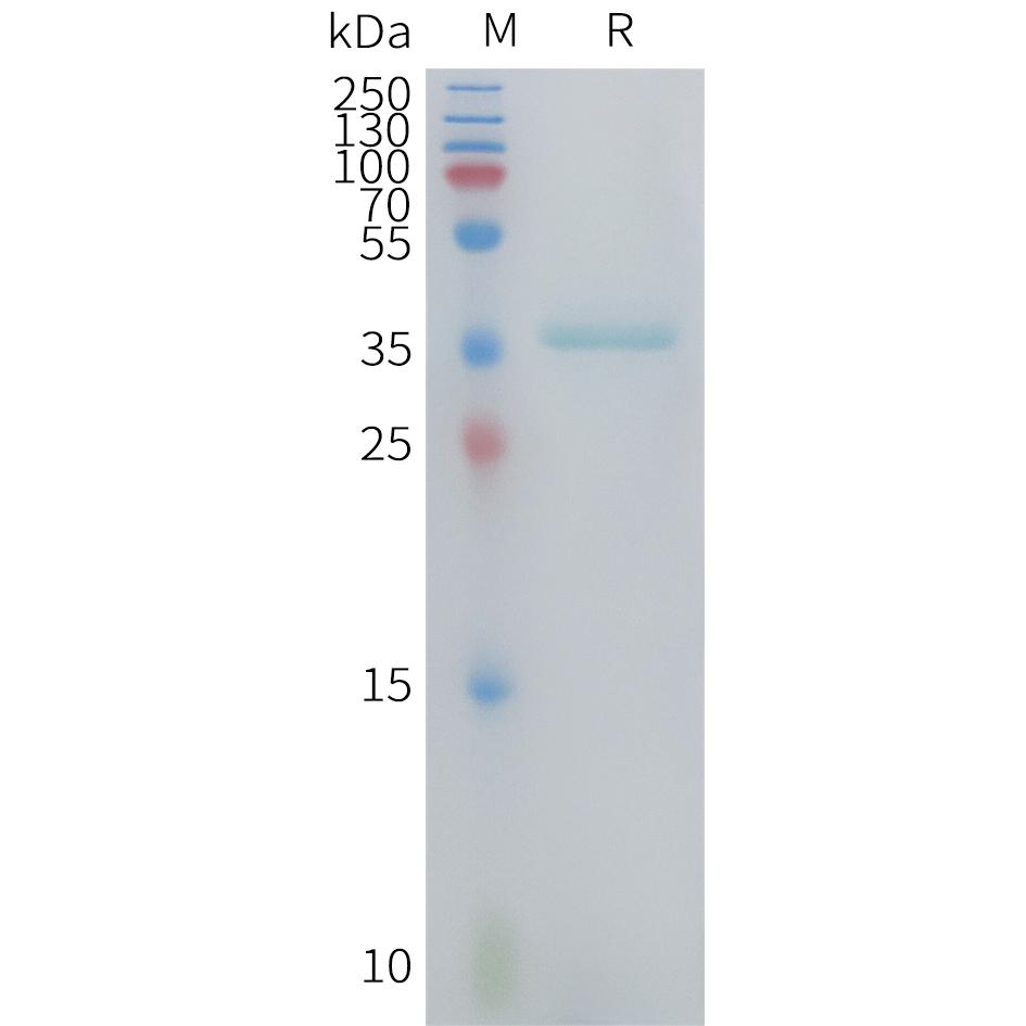 Human CCL3 Protein, hFc Tag