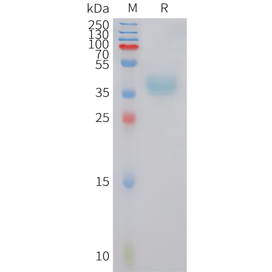 Human XCR1 Protein, hFc Tag