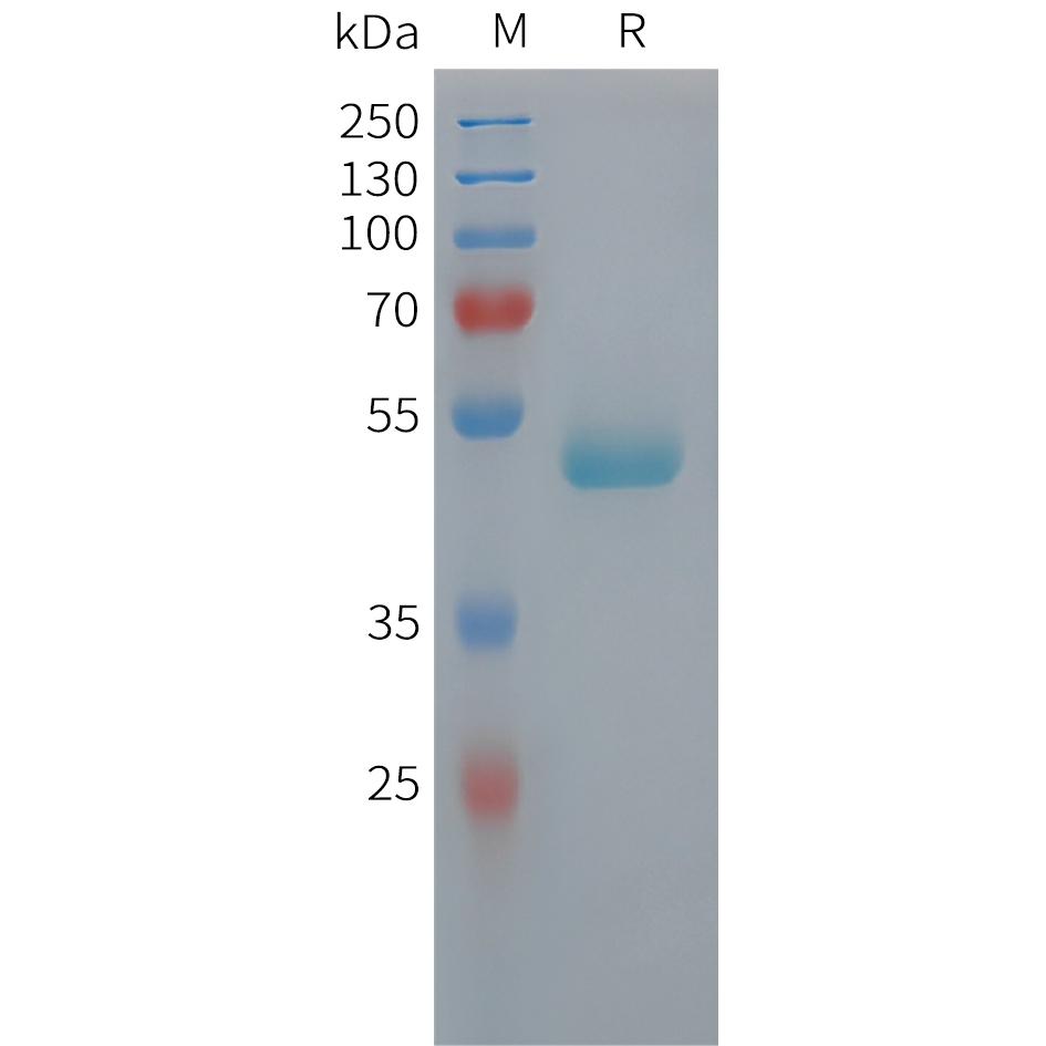 Human PEDF Protein, His Tag