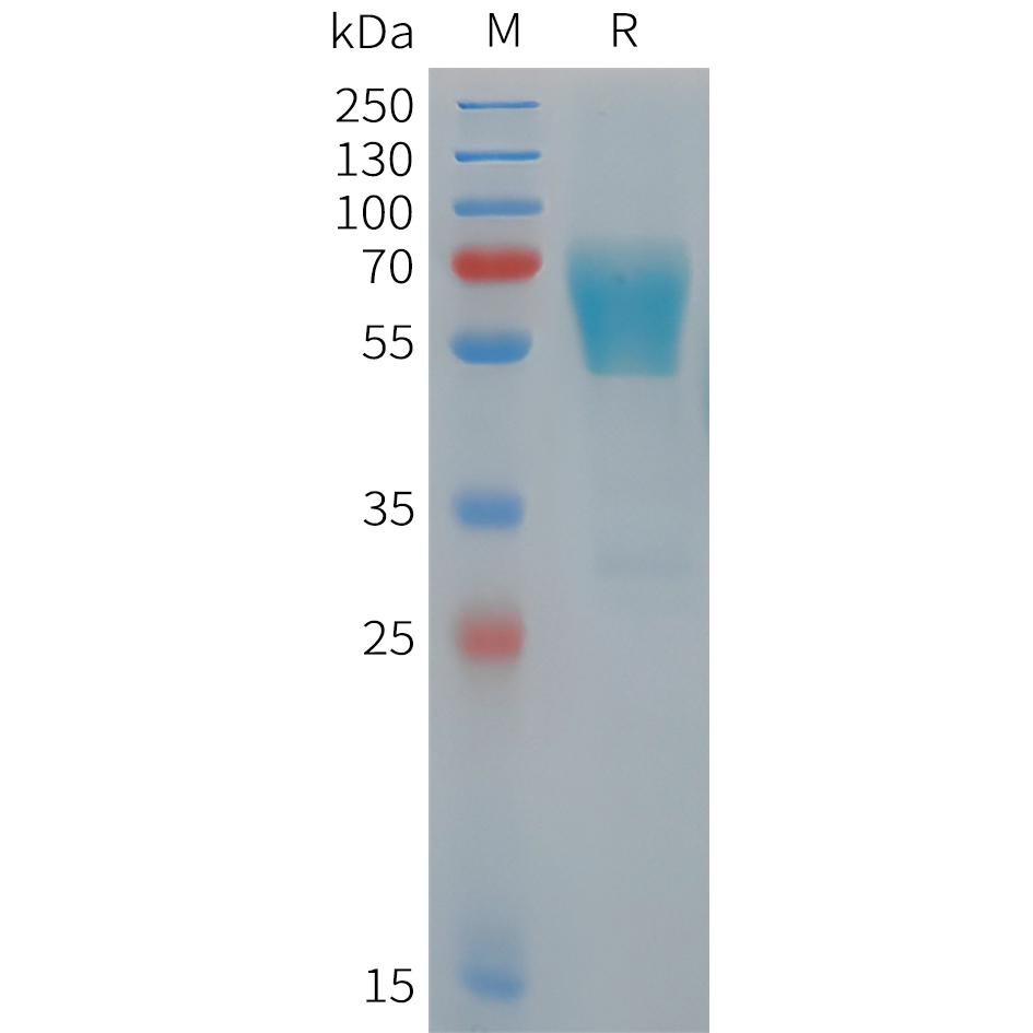 Human TIM3 Protein, hFc Tag