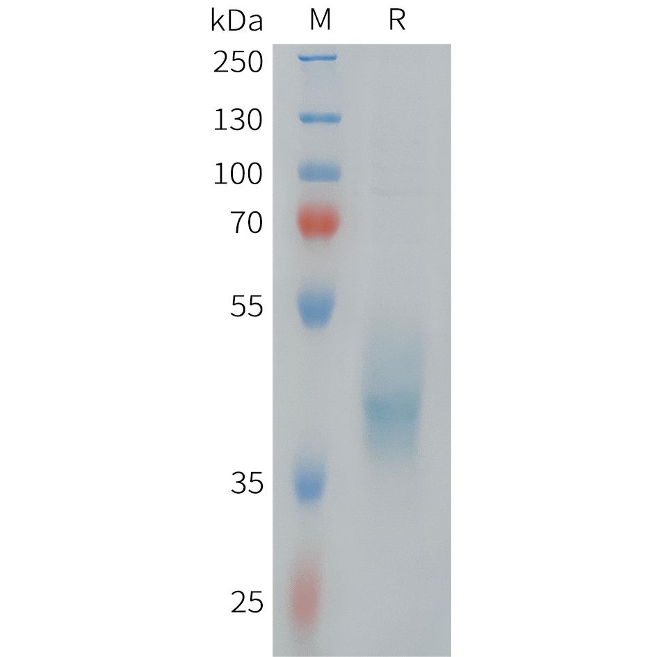 Human HER3(1243-1342) Protein, hFc Tag