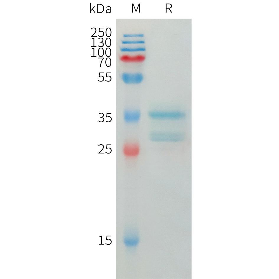 Human CXCL10 Protein, hFc Tag