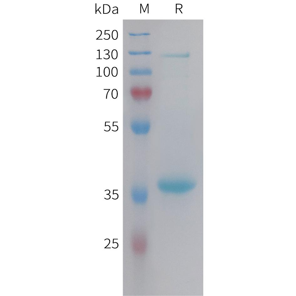 Human NPY Protein, hFc Tag