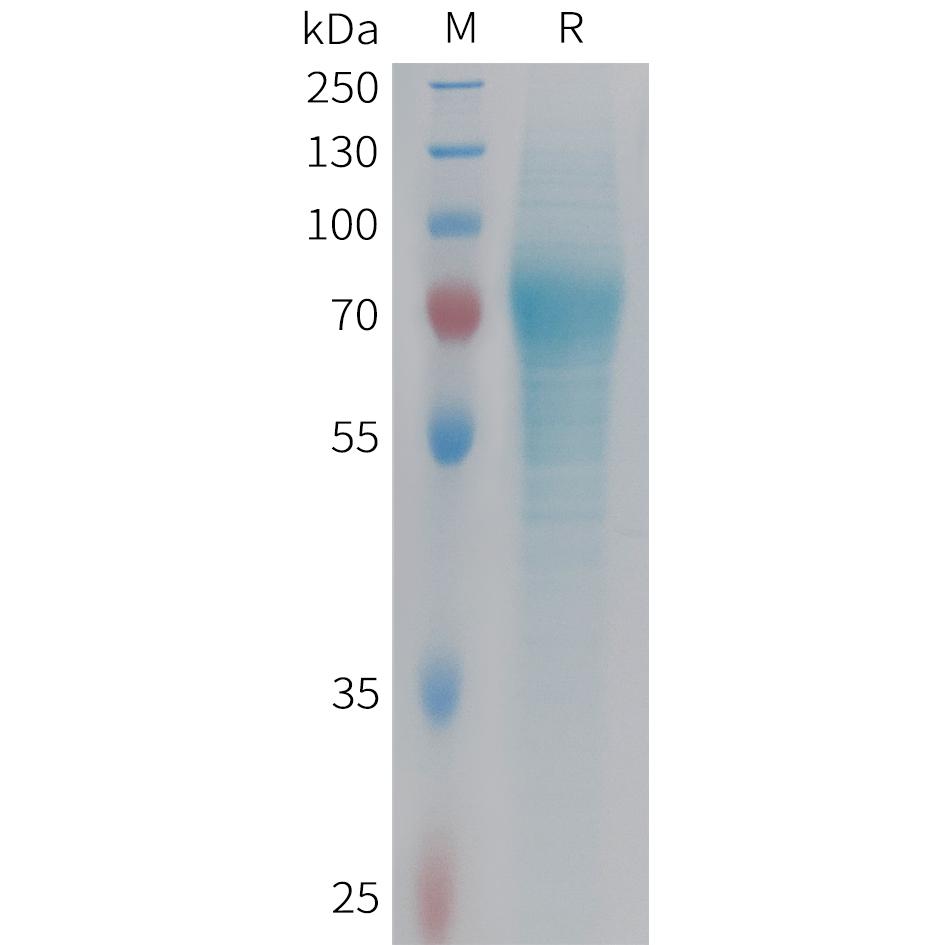 Human F9 Protein, His Tag