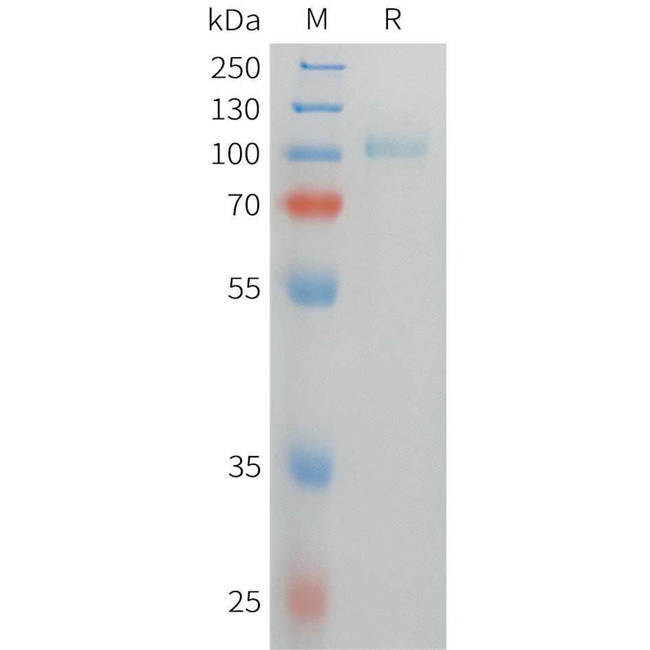 Human TPO Protein, His Tag