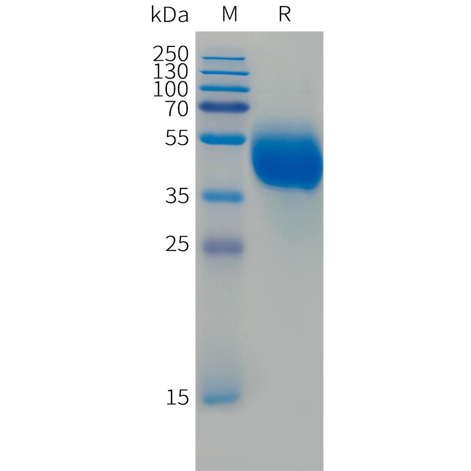 Human FCRL5(745-847)Protein, hFc Tag