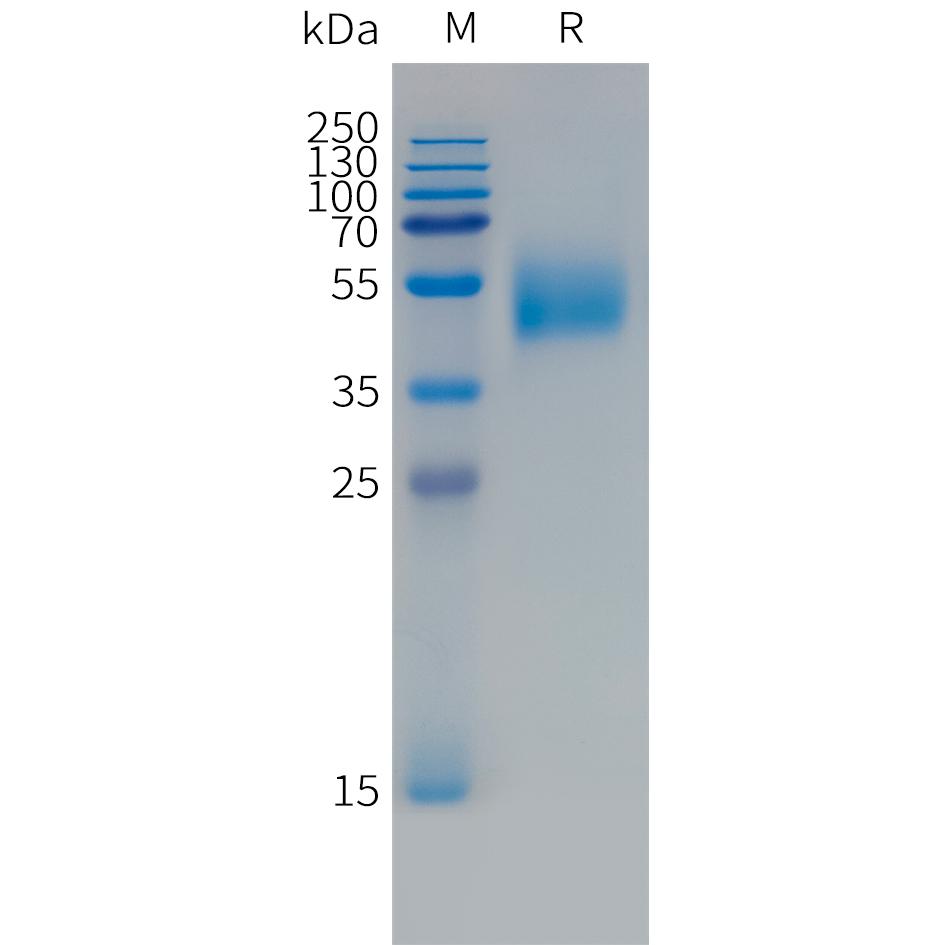 Human FCRL5(745-847)Protein, mFc Tag