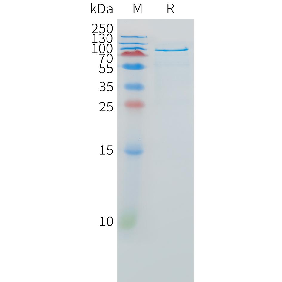 Human HGF(1-728) Protein, hFc Tag