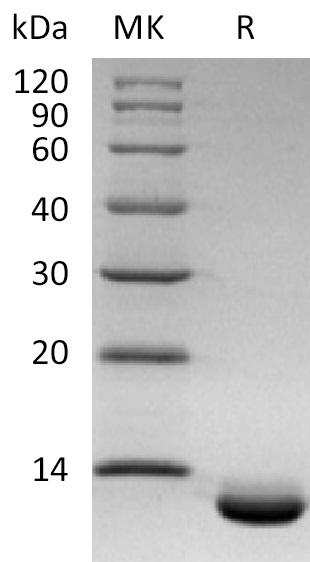 Human CXCL6 (C-6His) Protein