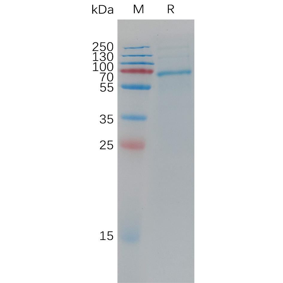 Cynomolgus ADAM9 Protein, His Tag