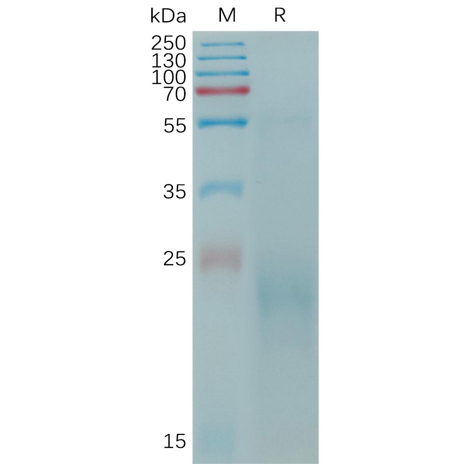 Cynomolgus CLEC4C Protein, His Tag