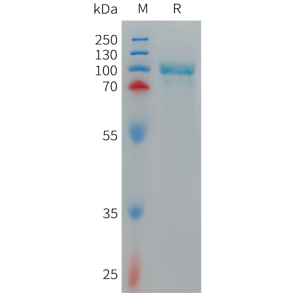 Cynomolgus CD93 Protein, His Tag