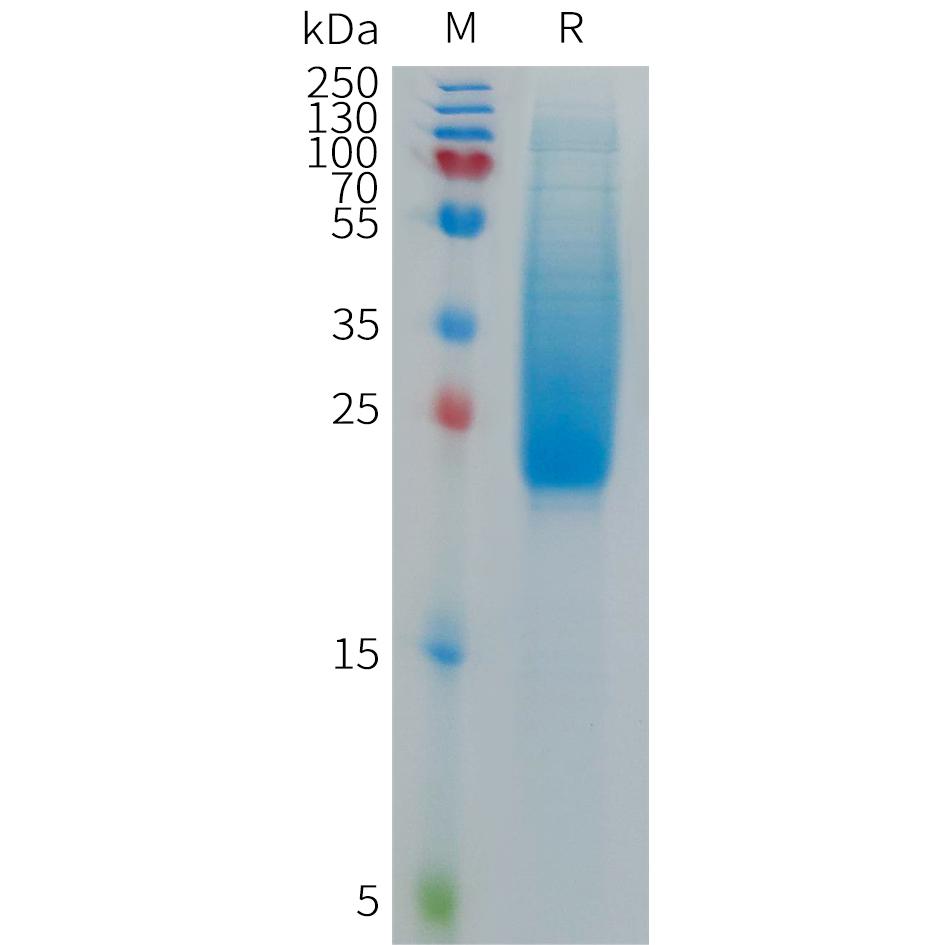 Cynomolgus IL18BP Protein, His Tag