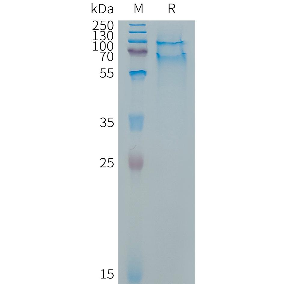 Cynomolgus SELPLG Protein, His Tag